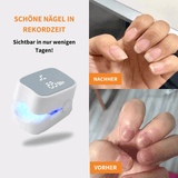 Felivo FungEx® – Revolutionäre Lösung gegen Nagelpilz