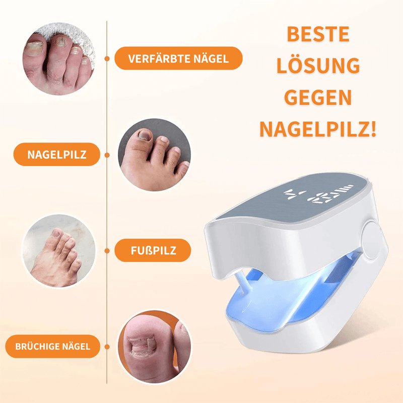 Felivo FungEx® – Revolutionäre Lösung gegen Nagelpilz